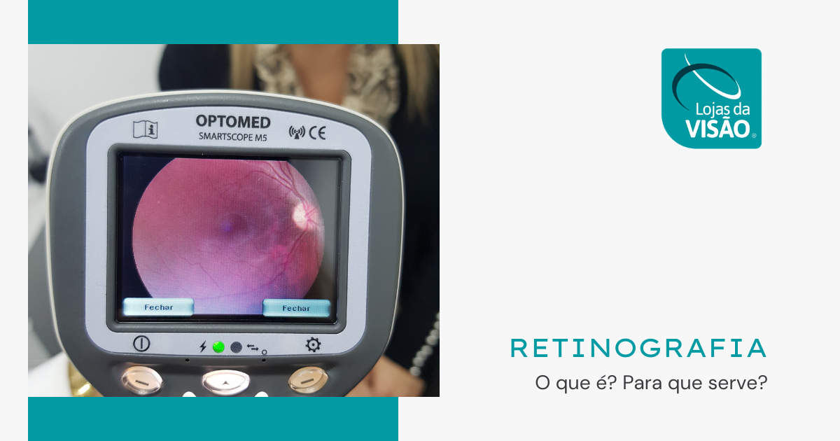 RETINOGRAFIA